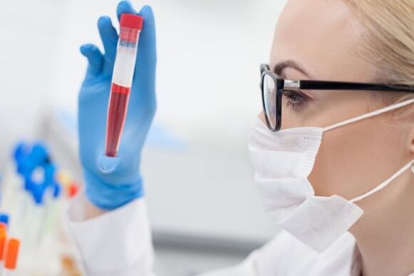 test sanguin pour l'hypertension